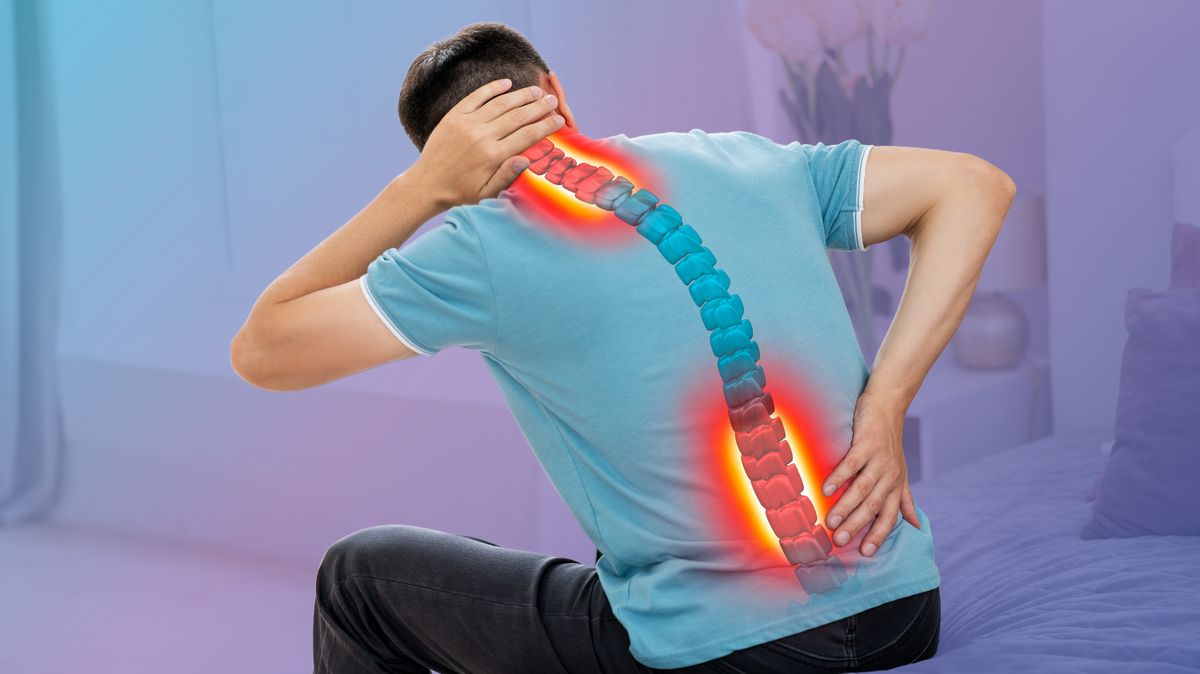 Cervical Lumbar Spondylosis1