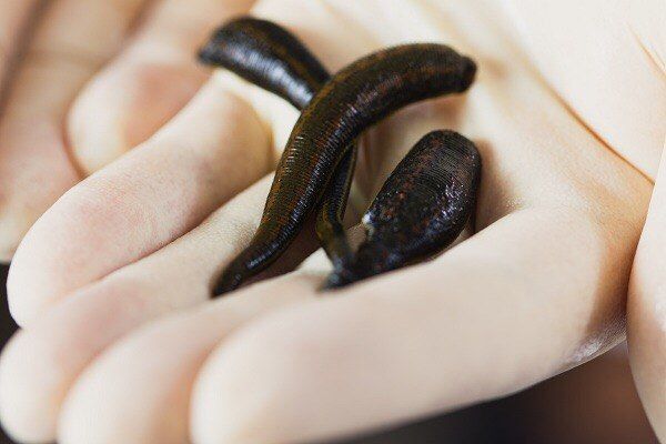 Leech Therapy4